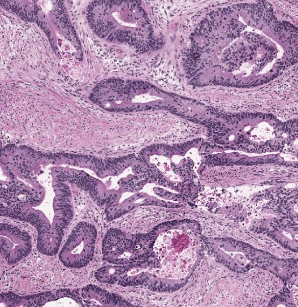 machine-learning-from-Digital-Pathology machine learning knowledge extraction digital pathology